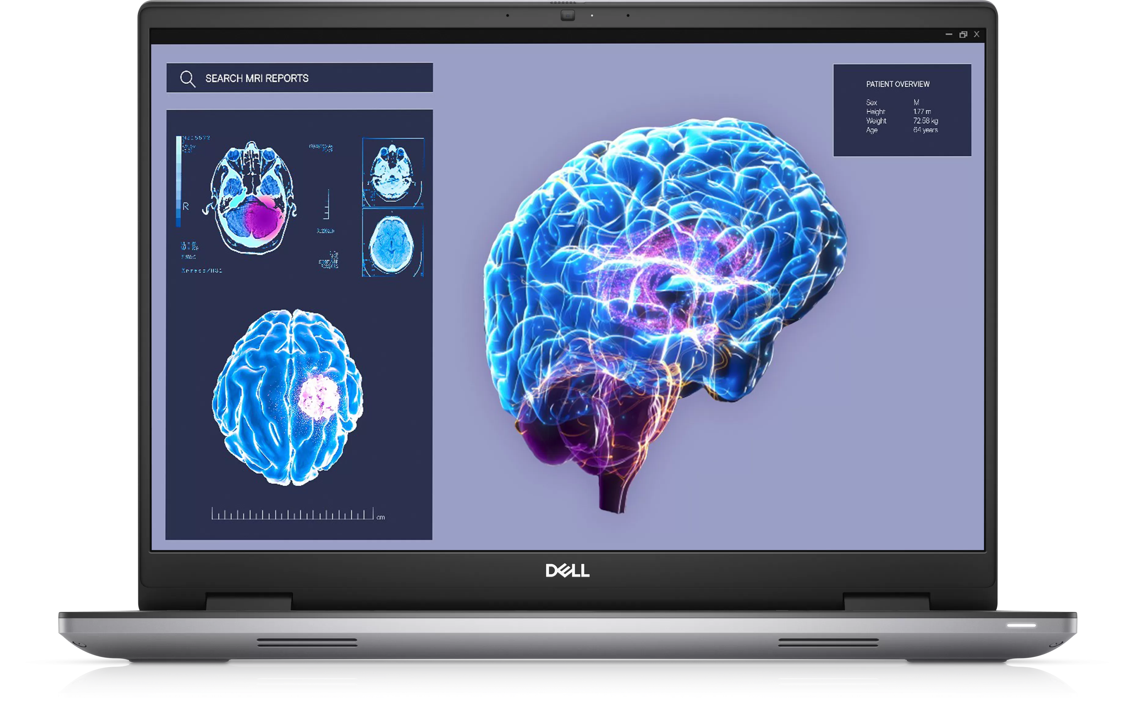 Notebook Dell Precision 7680, 16  Full HD+, Intel Core i7-13850HX, RTX 2000 Ada-8GB, RAM 32GB, SSD 512GB, Windows 10 Pro, NBD